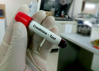 Poster - Blood sample for creatinine test. Diagnosis of kidney or renal disease