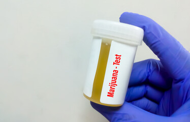 Poster - Urine drug test sample for Marijuana or Cannabinoids or DAST. to determine presence of illegal drugs in urine for judicial or medical practice