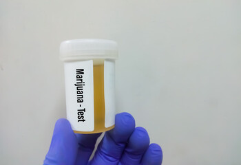 Poster - Urine drug test sample for Marijuana or Cannabinoids or DAST. to determine presence of illegal drugs in urine for judicial or medical practice