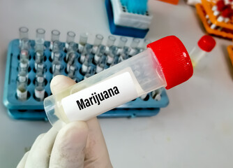 Poster - Urine drug test sample for Marijuana or Cannabinoids or DAST. to determine presence of illegal drugs in urine for judicial or medical practice