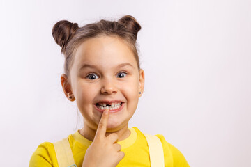 Wall Mural - Female kid with opened mouth pointing at missing front baby tooth with finger smiling excitedly in yellow t-shirt on white background. First teeth changing. Going to dentist to do tooth treatment. 