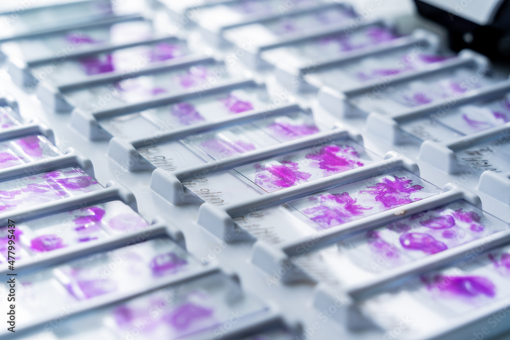 Rows of microscope glass slide in the cells Stock Photo | Adobe Stock
