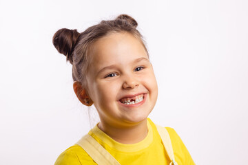 Wall Mural - Portrait of shining little kid showing missing front baby tooth and smiling looking away in yellow t-shirt on white background. First teeth changing. Going to dentist to do tooth treatment. 