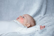 Newborn baby with dermatitis allergy.