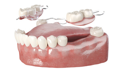 Wall Mural - 3d rendered illustration of a denture