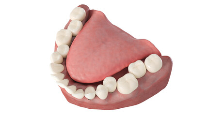 Wall Mural - 3d rendered illustration of overcrowded teeth