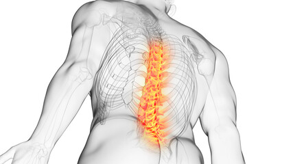 Poster - 3d rendered illustration of a painful spine