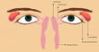 Lacrimal duct anatomy description. Green eyes illustration of lacrimal system structures.