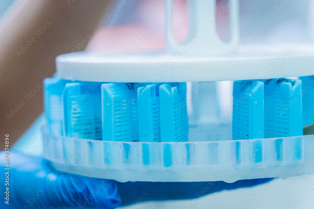 Laboratory assistant works with microwave hybrid tissue processor at ...