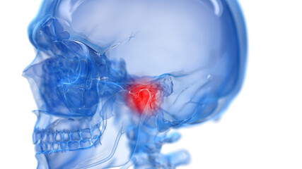 3d rendered illustration of a painful temporomandibular joint