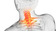 3d rendered illustration of a painful cervical spine