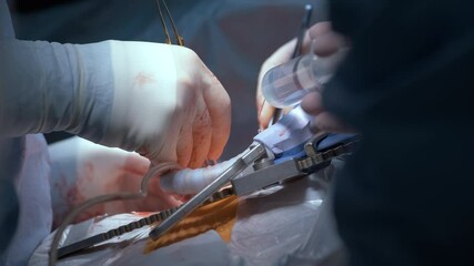 Wall Mural - Closeup of professional doctor hands operating a patient during open heart surgery in surgical room. Healthcare and medical intervention concept