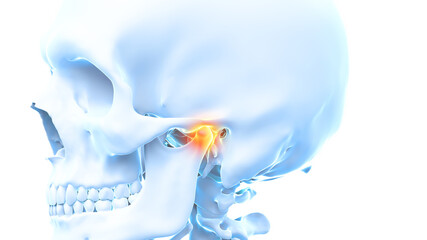 3d rendered illustration of a painful temporomandibular joint