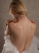 © dream@do - Checking benign moles : Beautiful Woman with birthmark on her back. Laser skin tags removal