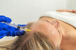 Mesotherapy procedure. A cosmetologist does a mesotherapy procedure in a woman's head. Strengthening hair and their growth