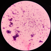 Gram Staining, It Is A Method Of Differentiating Bacterial Species Into Two Large Groups(Gram-positive And Gram-negative), Show Gram Positive Blue Color And Gram Negative Red Color