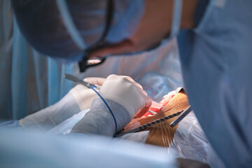 Wall Mural - Closeup of professional doctor hands operating a patient during open heart surgery in surgical room. Healthcare and medical intervention concept