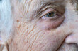 © berna_namoglu - close up eye of old person crying