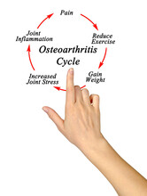 Five Components Of Osteoarthritis Cycle