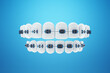 White teeth with metal braces on a blue background. Dental braces, orthodontic treatment, dentistry, teeth whitening, protection, oral care, hygiene, healthcare. 3D illustration, 3D render.