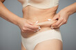 © Юлия Призова - The girl tightens the skin on her stomach, showing fat deposits in the abdomen and sides. Treatment and getting rid of excess weight, deposition of subcutaneous fat.