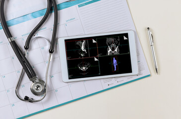 Wall Mural - Doctor medical worktable with stethoscope on research in medicine MRI scan of the patient