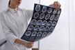 © New Africa - Doctor examining MRI images of patient with multiple sclerosis in clinic, closeup