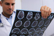 © New Africa - Doctor examining MRI images of patient with multiple sclerosis in clinic, closeup