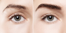 Comparison Of Female Brow After Eyebrow Shape Correction