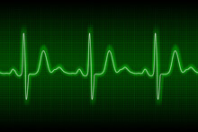 Heart Beat Ecg Or Ekg Seamless Neon Line On Green Background. Electrocardiogram Graph Of Healsh Cardio Rate. Examination Of Human Health. Medicine Test Cardiac Rhythm And Pulsating Inteval.
