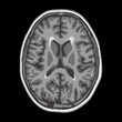 Brain MRI axial cut