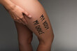 © LIGHTFIELD STUDIOS - cropped view of nude woman with my body my choice lettering on hip isolated on dark grey
