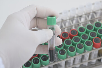 Selective focus scientist hand holding blood test tube for fast laboratory.Technician during work at biochemistry unit in hospital.