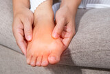 Fototapeta Uliczki - Close-up of a woman massage painful toes at home. Bare foot of woman with painful red bunion (Hallux valgus) and injury foot, Problems from wearing high heel. medical foot problem.