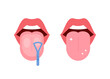 Clean tongue throat cleaner scraper in mouth. Before and after tongue cleaning. Halitosis prevention. Vector illustration