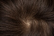 © Alessandro Grandini - Woman scalp center with healthy hair