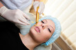 © fotofrol - Beautiful woman getting lifting injection in cheekbones. Injections of skin rejuvenation.