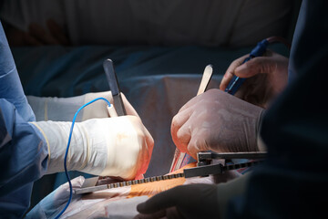 Wall Mural - Closeup of professional doctor hands operating a patient during open heart surgery in surgical room. Healthcare and medical intervention concept