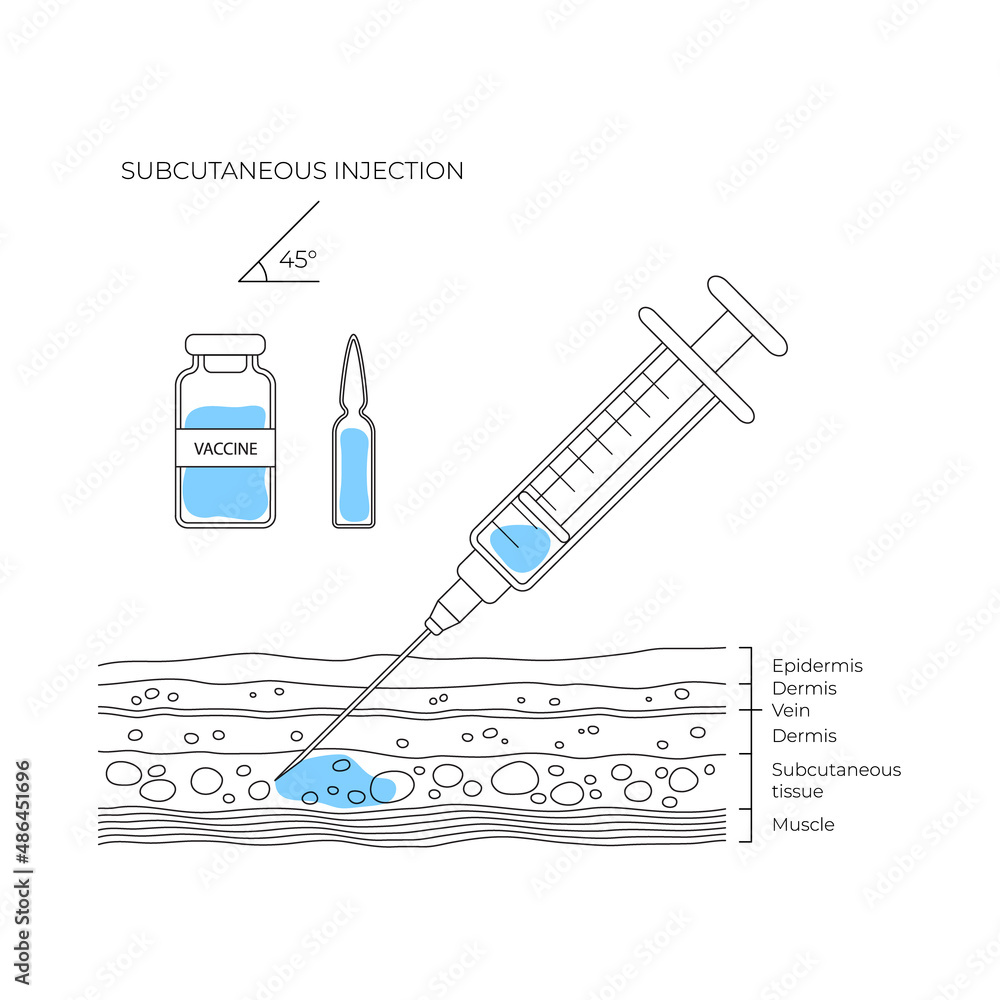 Types of injections. Guide to injecting vaccines into skin. Vector ...