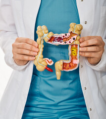 Treatment of colitis, flatulence, indigestion in healthcare. Anatomical intestines model with pathology in doctor hands, close-up