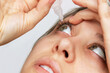 Close-up of woman dripping her eyes with medicinal drops natural tear. Disease of eye retina. Conjunctivitis, keratitis, dry eye syndrome, trauma. Treatment of red inflamed capillaries