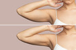 © Марина Демешко - Cropped shot of young woman with excess fat on her upper arm before and after plastic surgery isolated on beige background. Loose and saggy muscles. Result of loosing weight diet, liposuction,training