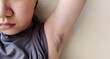 © Rung Kh - portrait a teenage woman showing the armpit hair, concept health care.