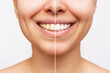 Cropped shot of a young smiling woman before and after teeth whitening isolated on a white background. Dark tooth enamel, contrast. Dentistry, dental care