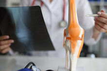 Doctor Traumatologist Demonstrating Bones Of Knee Joint On Artificial Model And Taking Xray Picture Closeup