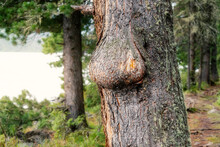 Neoplasm Or Burl On The Trunk Of A Pine Tree In The Forest. The Concept Of Nature Health And Forestry And Wood Quality