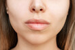 © Марина Демешко - Cropped shot of young caucasian blonde woman's face with perfect lips after lip enhancement. Injection of filler in lips. Result of a lip augmentation. Close-up