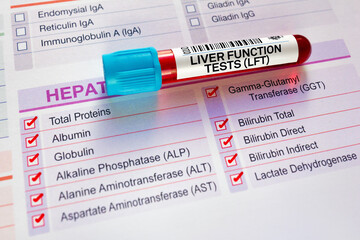 Wall Mural - Blood sample tube for analysis of LFT Liver Function Tests in laboratory. Blood tube test with requisition form for Liver Function Tests LFT Hepatic Profile