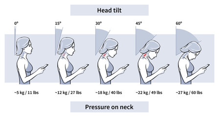 Load on neck and back when posture tilting head with phone, pain of weight, outline. Angle of bending head related to pressure on spine. Stage text neck syndrome. Vector illustration