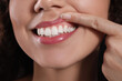 © New Africa - Young woman showing healthy gums, closeup view